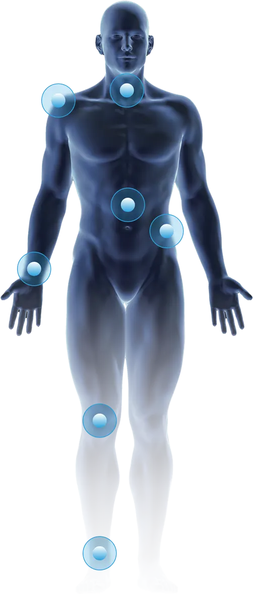 Body diagram highlighting the treatment areas the NICE1 wraps cover